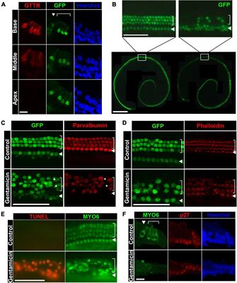 CDK2 regulates aminoglycoside-induced hair cell death through modulating c-Jun activity: Inhibiting CDK2 to preserve hearing